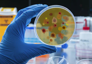 A gloved hand holds a petri dish with bacterial colonies.