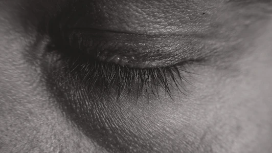Closed eye with prominent eyelashes.