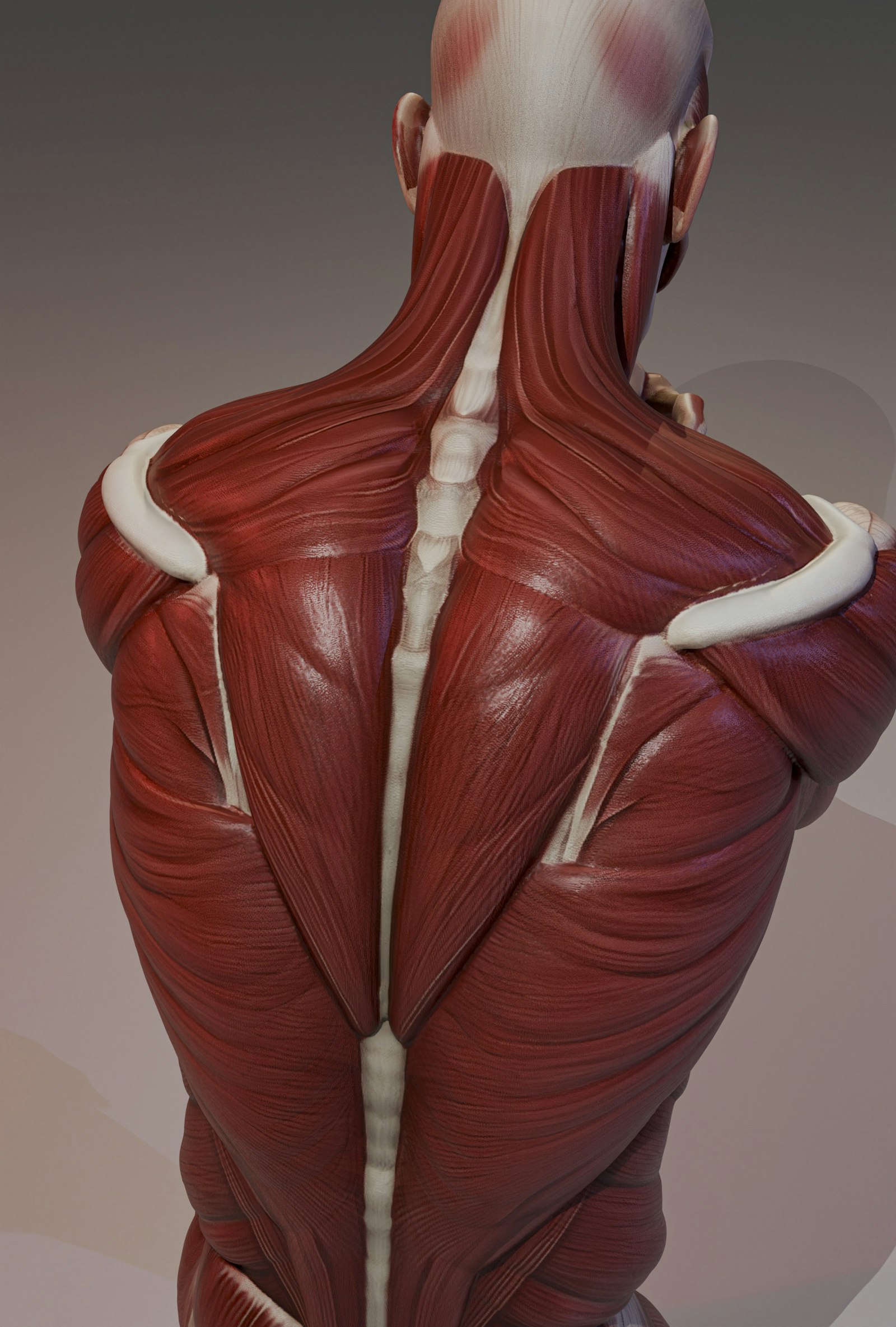 Where the nerve leaves the spine is usually the story