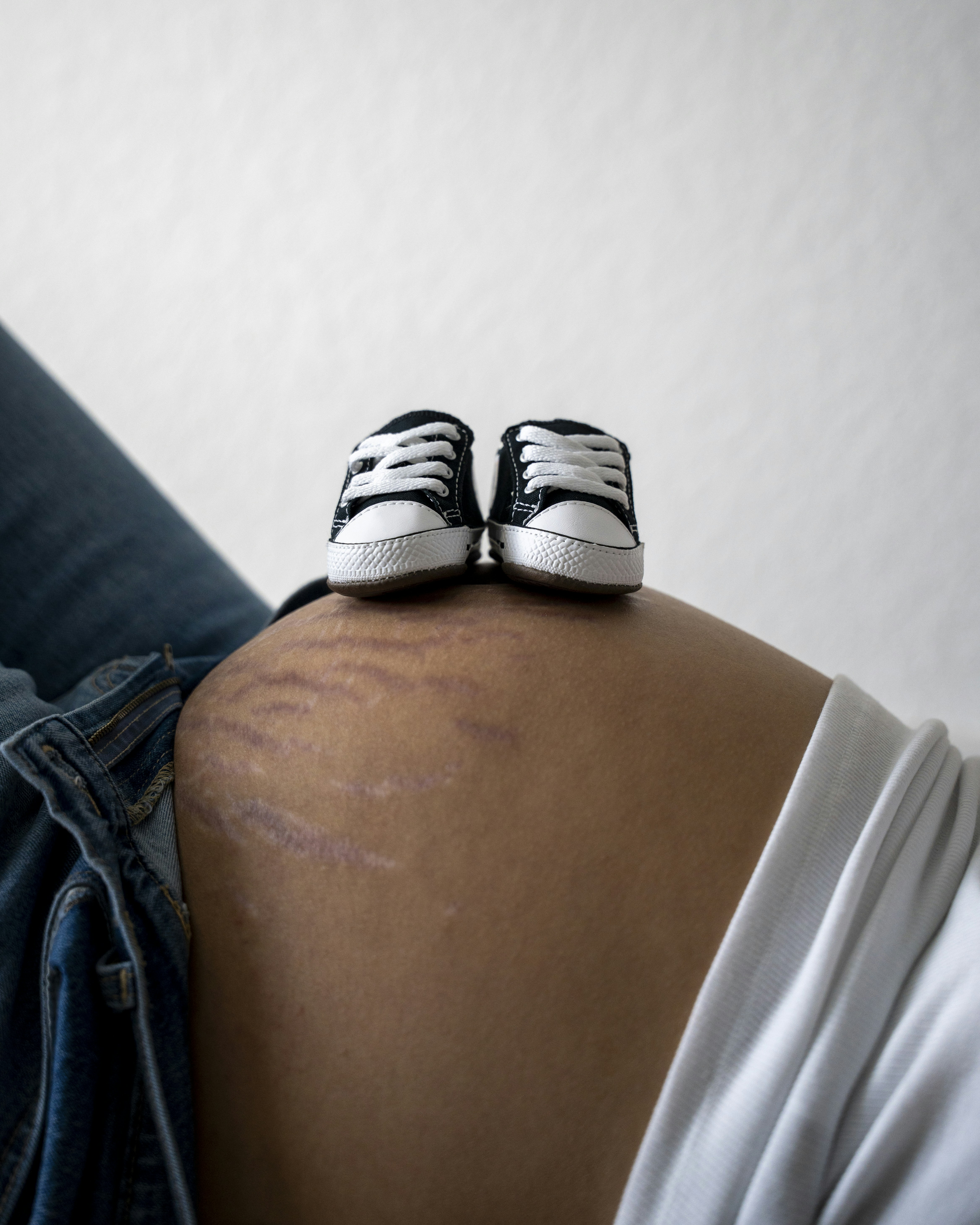 Sepatu bayi di perut hamil dengan stretch mark.