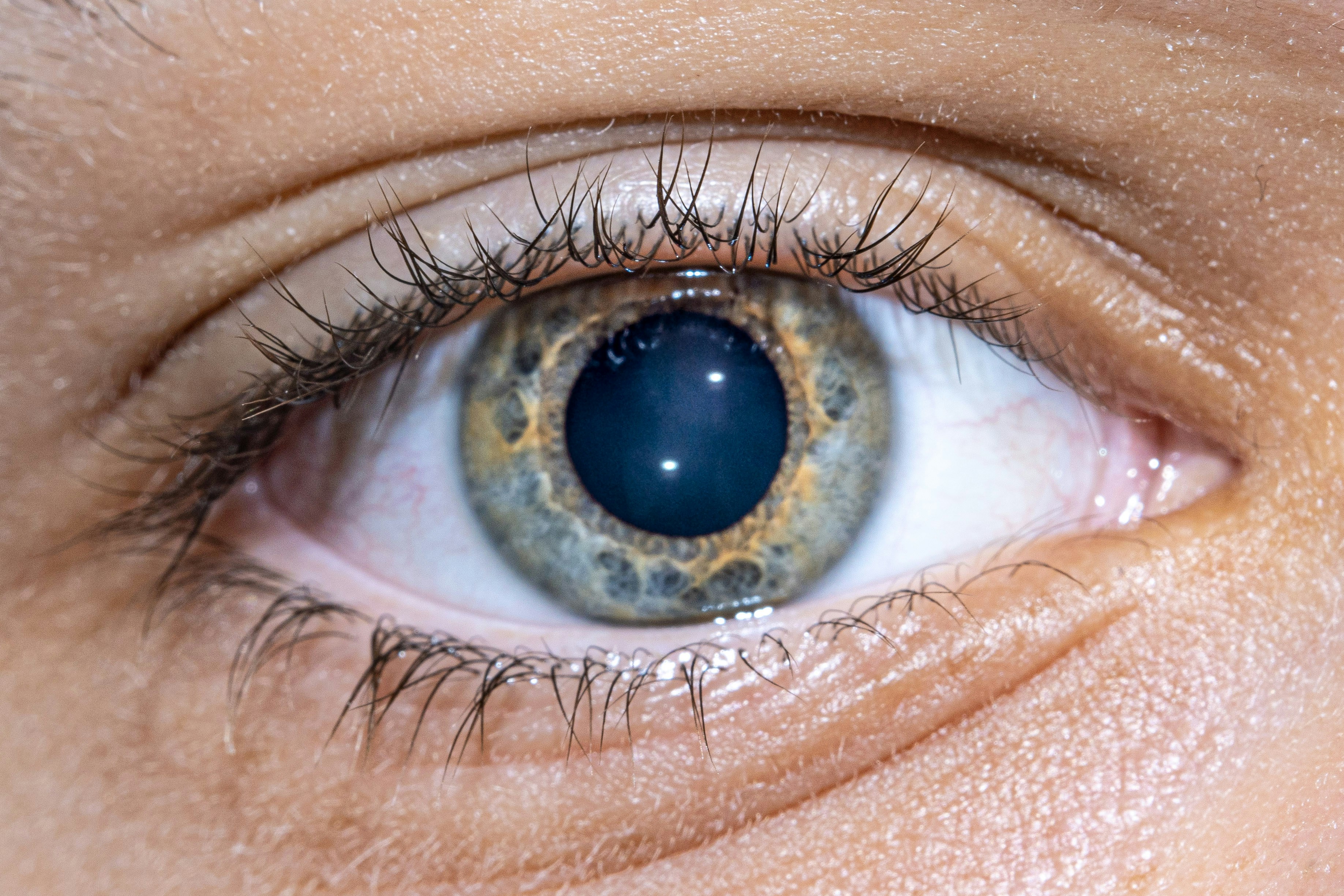 Un ojo humano con pupila azul e iris multicolor