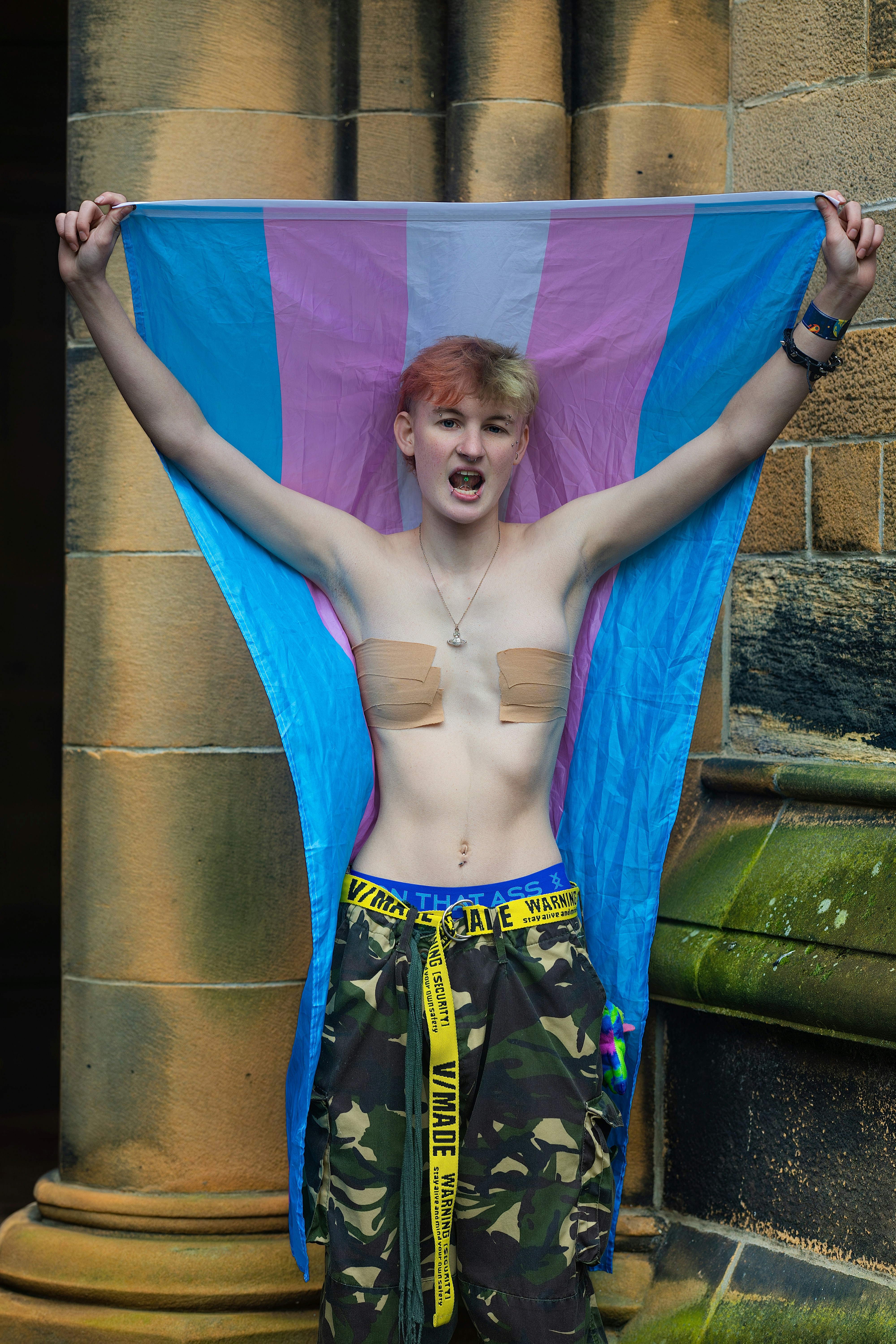 The Psychopathology Behind the Third-Gender Proposal