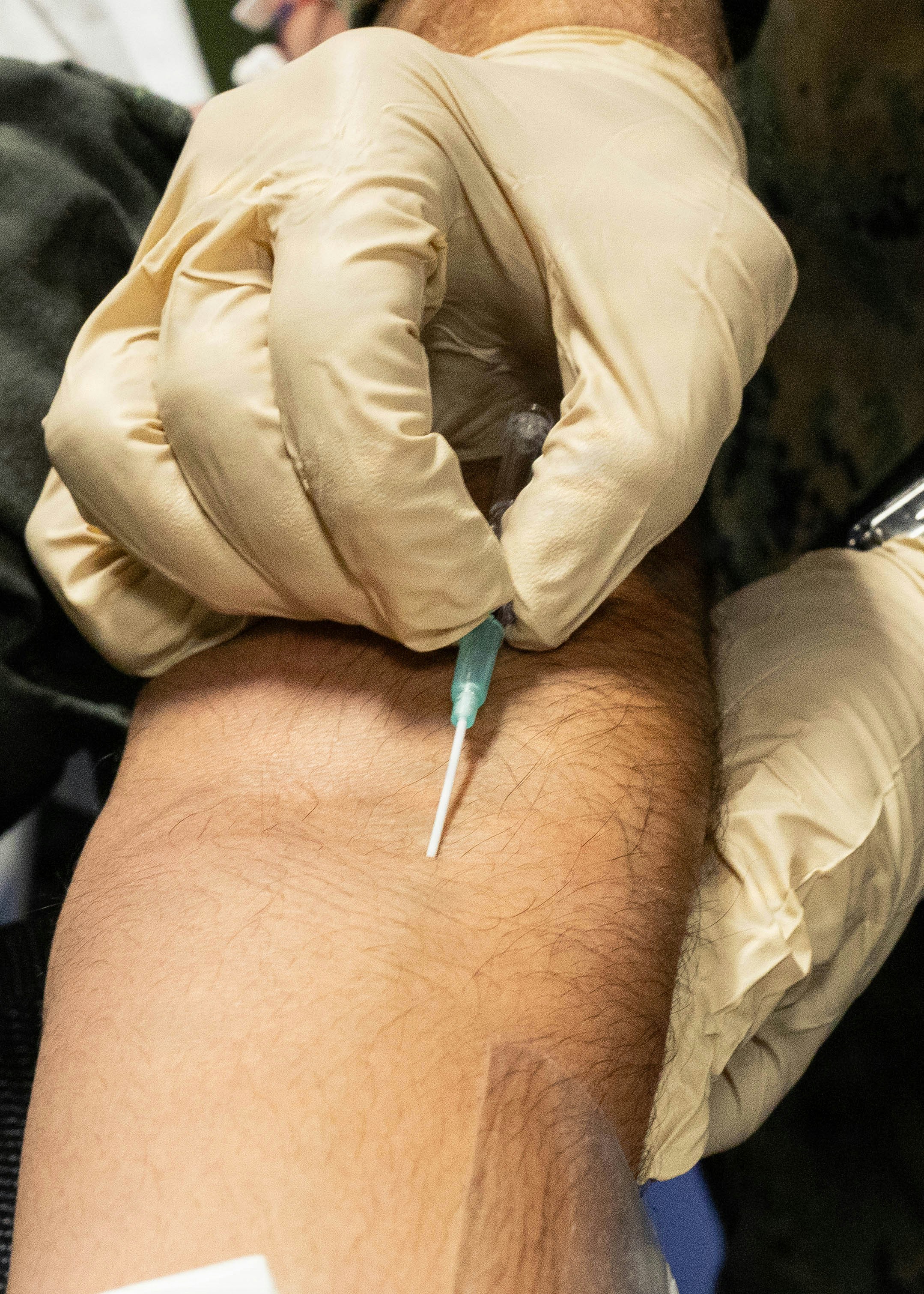 A person in latex gloves inserting a needle into a forearm.
