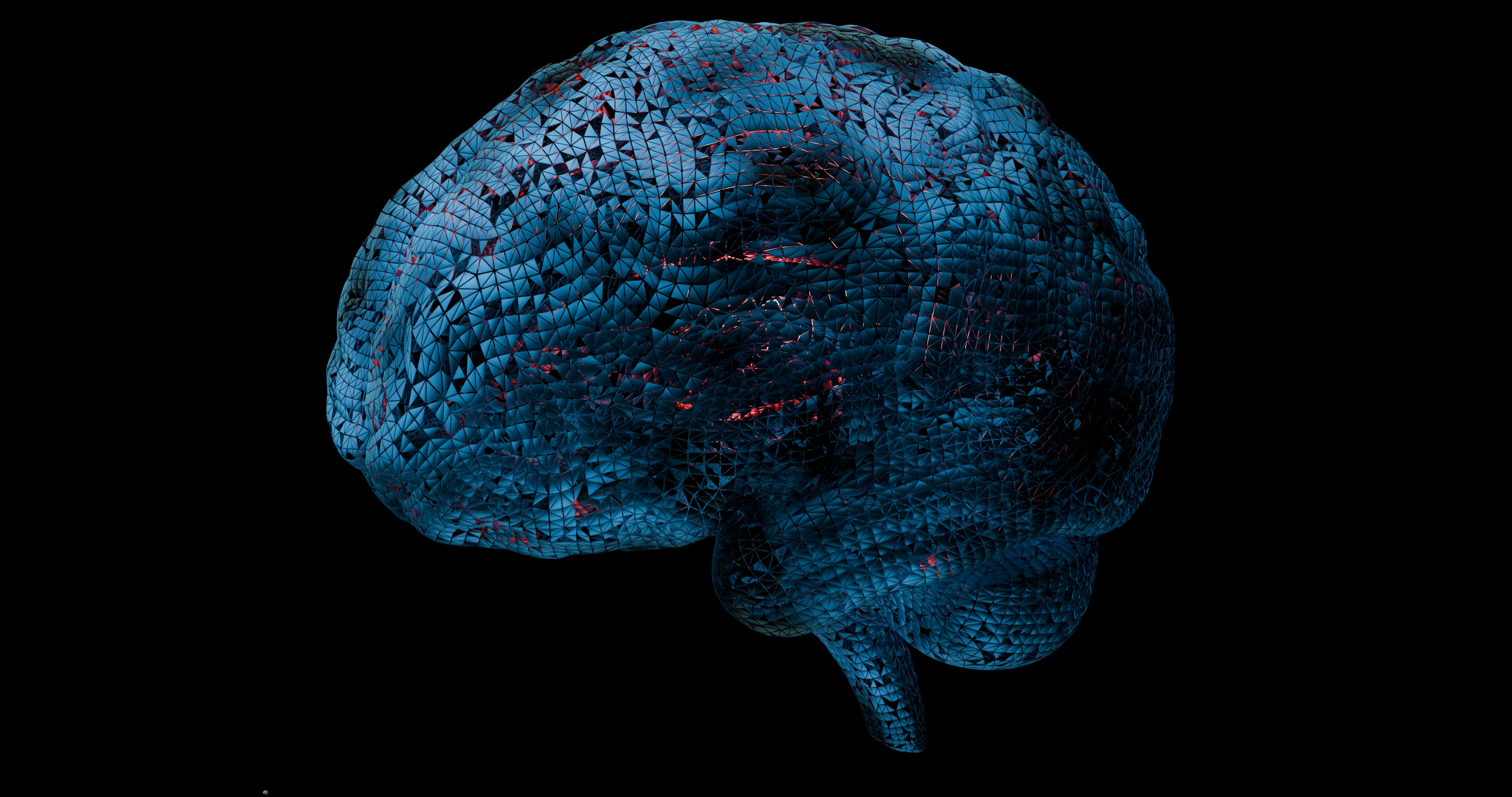 Theta burst stimulation significantly improves motor symptoms and reduces depressive scores in Parkinson's disease