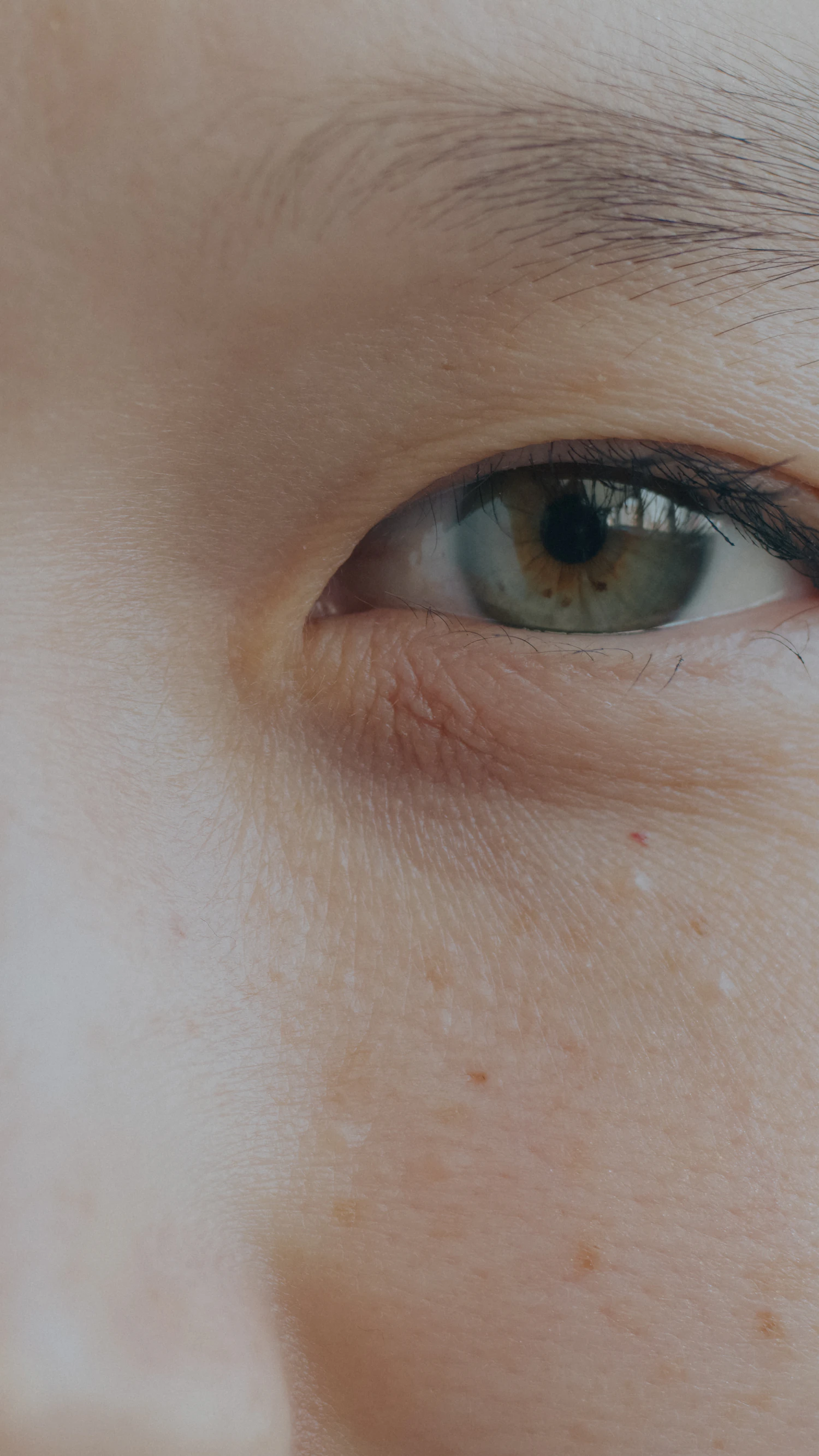 A pale eye photographed close, the skin texture of the lower lid in focus