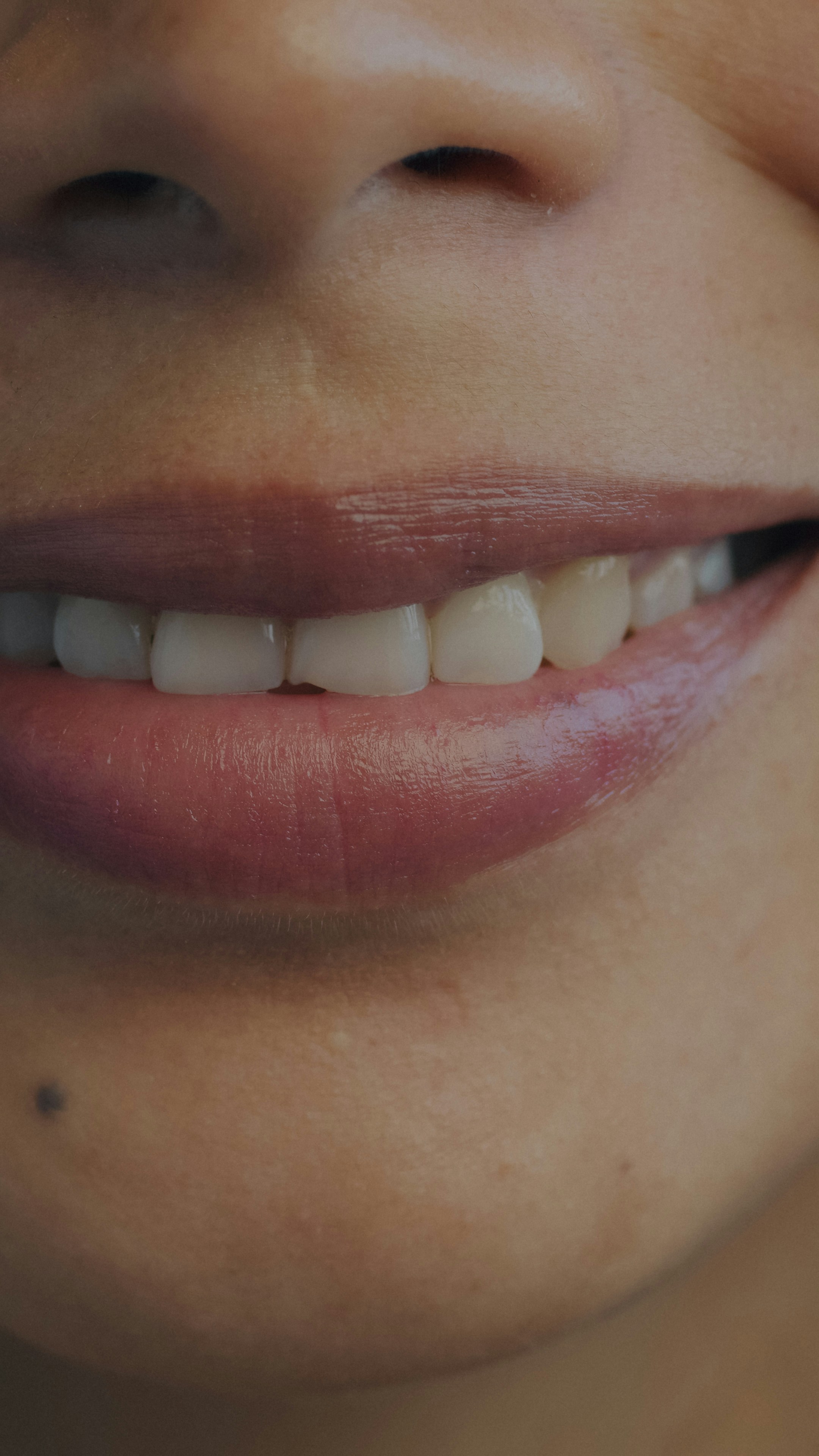 close up nose skin, wallpaper, How To Get Rid Of Inflammatory Acne On Nose 5