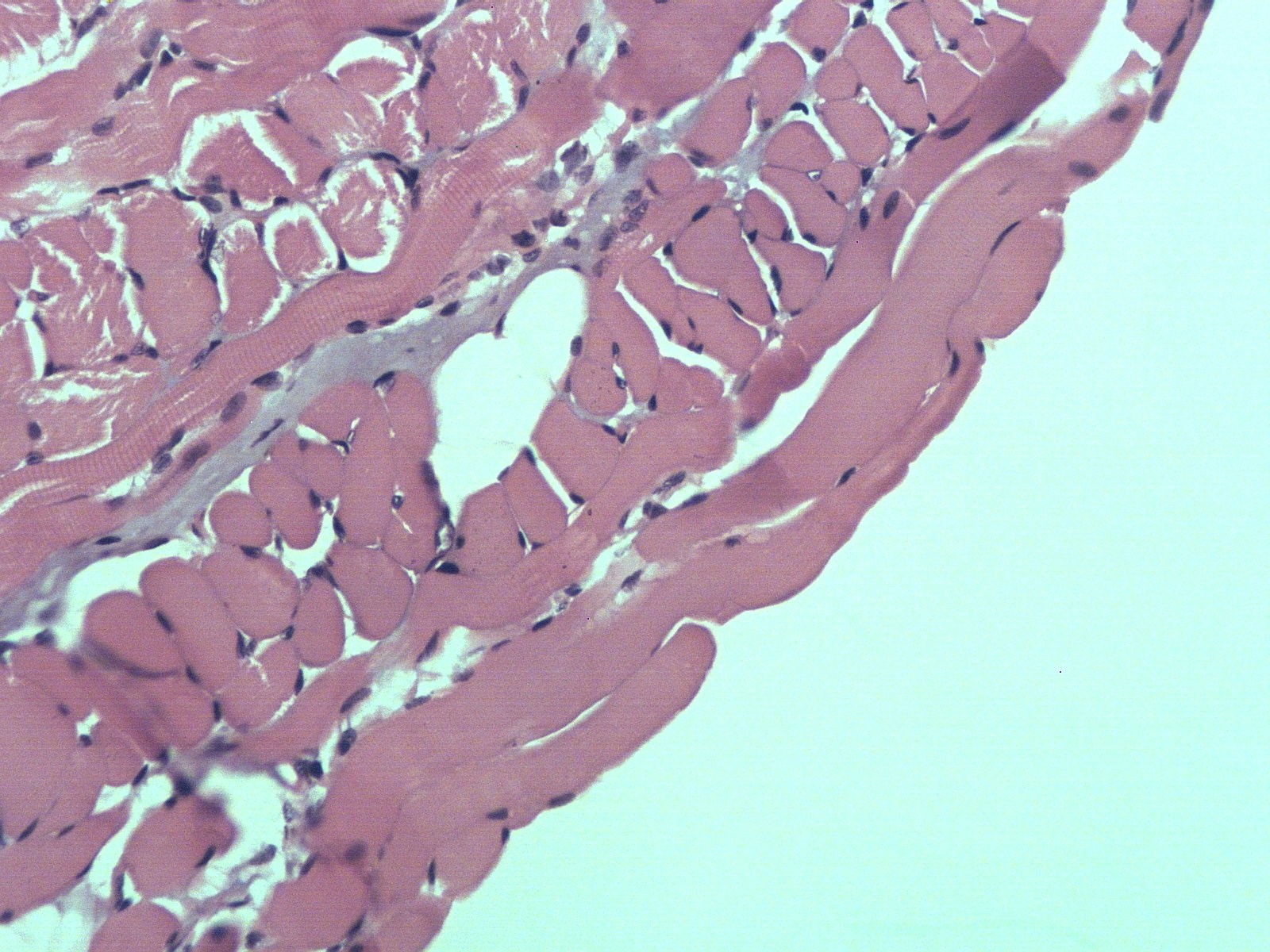 Go to tractor tractor's profile