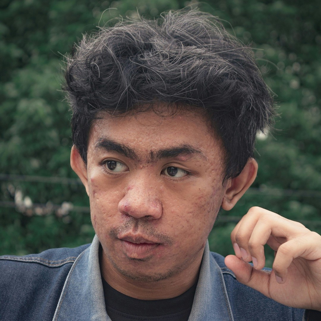 Go to Ervin Erviansyah's profile